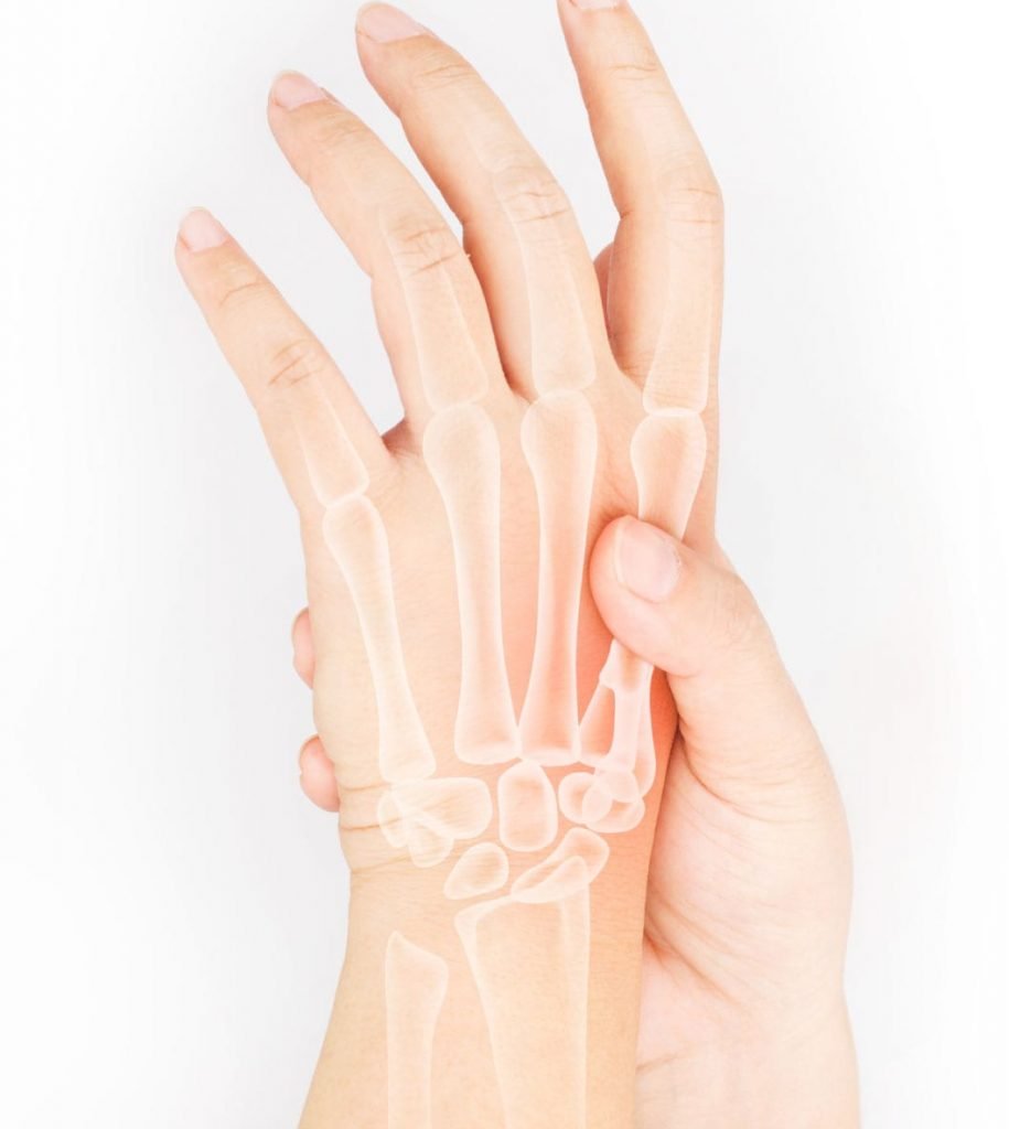 Tratamiento para la osteoartritis