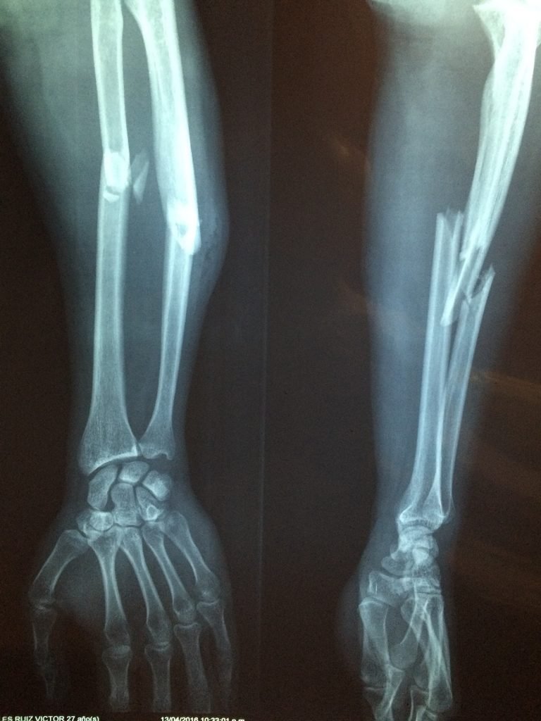 especialista en rodilla en Campeche