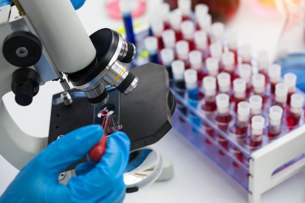 tratamiento para osteoartritis