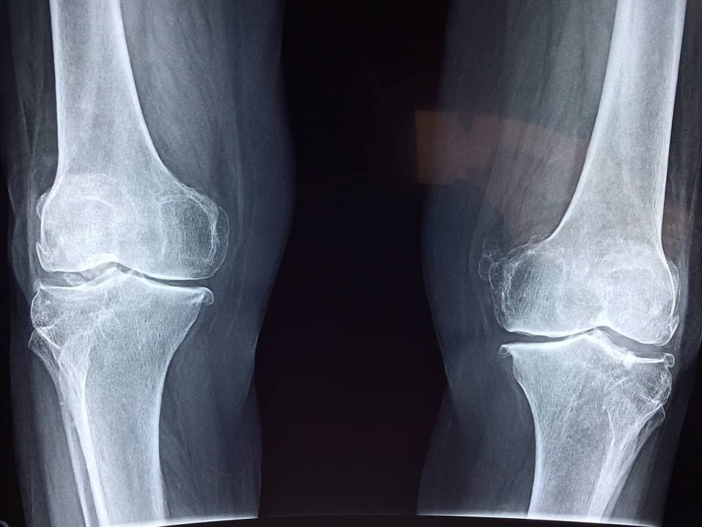 Especialista en rodilla